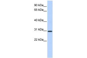 WB Suggested Anti-BCAS2 Antibody Titration:  0. (BCAS2 anticorps  (N-Term))