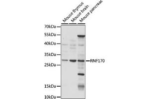 Western blot analysis of extracts of various cell lines, using RNF170 antibody (ABIN7270064) at 1:1000 dilution.