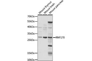 Western blot analysis of extracts of various cell lines, using RNF170 antibody (ABIN7270064) at 1:1000 dilution. (RNF170 anticorps  (AA 46-120))