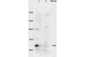 Lane 1: mouse kidney lysates Lane 2: mouse embryo lysates probed with Anti phospho-eIF4EBP1/4EBP1(Ser64) Polyclonal Antibody, Unconjugated (ABIN682963) at 1:200 in 4 °C. (eIF4EBP1 anticorps  (pSer65))