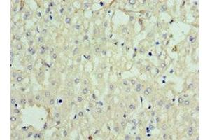 Immunohistochemistry of paraffin-embedded human liver tissue using ABIN7168634 at dilution of 1:100