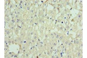 Immunohistochemistry of paraffin-embedded human liver tissue using ABIN7168634 at dilution of 1:100 (Sclerostin anticorps  (AA 24-213))