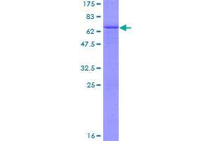 Image no. 1 for Epilepsy, Progressive Myoclonus Type 2A, Lafora Disease (Laforin) (EPM2A) (AA 1-331) protein (GST tag) (ABIN1352957)