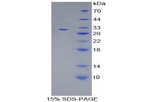 SDS-PAGE (SDS) image for Mitogen-Activated Protein Kinase 7 (MAPK7) (AA 185-419) protein (His tag) (ABIN2125899) (MAPK7 Protein (AA 185-419) (His tag))