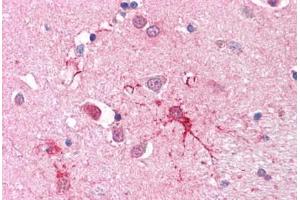 Human Brain, Basal Ganglia (SLC1A4 anticorps  (C-Term))