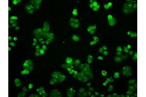 Image no. 4 for anti-Protein Phosphatase 5, Catalytic Subunit (PPP5C) antibody (ABIN1500390)