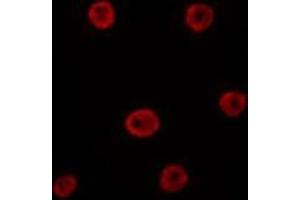 ABIN6275800 staining HepG2 by IF/ICC. (GATA6 anticorps  (Internal Region))