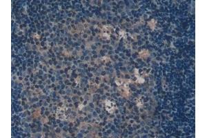 Detection of IL2Ra in Mouse Lymph node Tissue using Polyclonal Antibody to Interleukin 2 Receptor Alpha (IL2Ra)