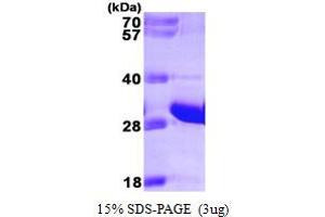 SDS-PAGE (SDS) image for Fas (TNFRSF6)-Associated Via Death Domain (FADD) (AA 1-208) protein (His tag) (ABIN667749) (FADD Protein (AA 1-208) (His tag))