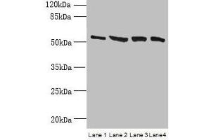 Western blot All lanes: CCDC112 antibody at 12 μg/mL Lane 1: Jurkat whole cell lysate Lane 2: Hela whole cell lysate Lane 3: HepG2 whole cell lysate Lane 4: A549 whole cell lysate Secondary Goat polyclonal to rabbit IgG at 1/10000 dilution Predicted band size: 54, 62 kDa Observed band size: 54 kDa (CCDC112 anticorps  (AA 201-446))