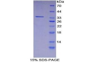 SDS-PAGE analysis of Mouse CARD9 Protein. (CARD9 Protéine)