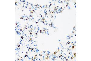 Immunohistochemistry of paraffin-embedded rat lung using FMRP antibody (ABIN6133703, ABIN6140719, ABIN6140721 and ABIN6221705) at dilution of 1:100 (40x lens).
