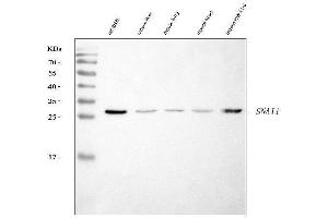 Western blot analysis of SNAIL/SNAI1 using anti-SNAIL/SNAI1 antibody (ABIN7599028). (SNAIL anticorps  (AA 1-170))