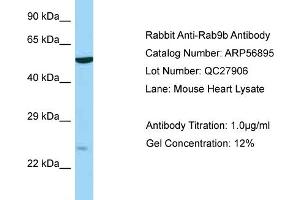Western Blotting (WB) image for anti-RAB9B, Member RAS Oncogene Family (RAB9B) (N-Term) antibody (ABIN2786963) (RAB9B anticorps  (N-Term))