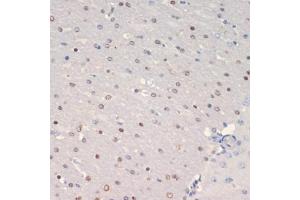 Immunohistochemistry of paraffin-embedded mouse brain using Olig2 antibody (ABIN6128396, ABIN6145015, ABIN6145016 and ABIN6216575) at dilution of 1:200 (40x lens). (OLIG2 anticorps  (AA 1-80))
