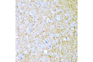 Immunohistochemistry of paraffin-embedded rat brain using WNT2 antibody at dilution of 1:200 (40x lens). (WNT2 anticorps)