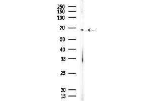 Western blot analysis of lysates from EC304 cells, using CCNK Antibody at 1/1000 dilution.