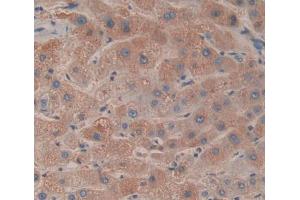 IHC-P analysis of liver tissue, with DAB staining. (ACADS anticorps  (AA 210-396))