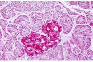 Image no. 1 for anti-Ferritin, Mitochondrial (FTMT) (AA 98-147) antibody (ABIN6749792)