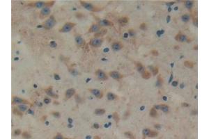 Detection of TXLNa in Mouse Cerebrum Tissue using Polyclonal Antibody to Taxilin Alpha (TXLNa) (alpha Taxilin anticorps  (AA 1-234))