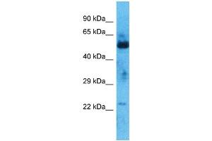 Host:  Rabbit  Target Name:  ZNF772  Sample Type:  Thymus Tumor lysates  Antibody Dilution:  1. (ZNF772 anticorps  (N-Term))