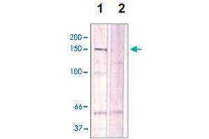 The cell lysate derived from Conditioned NIH/3T3 cell was immunoprecipitated by ROCK2 (phospho T396) polyclonal antibody , then immunoprobed by the same antibody at 1 : 500 (lane 1). (ROCK2 anticorps  (pThr396))
