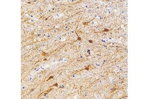 IHC analysis of MAP2 using anti-MAP2 antibody (ABIN7601483).