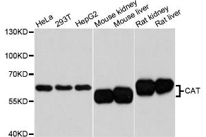 Western blot analysis of extracts of various cell lines, using CAT antibody. (Catalase anticorps)