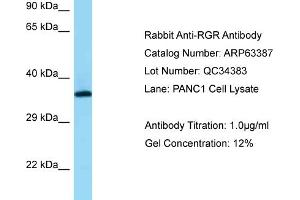 Western Blotting (WB) image for anti-Retinal G Protein Coupled Receptor (RGR) (N-Term) antibody (ABIN2774370) (RGR anticorps  (N-Term))