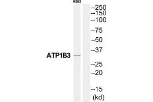 Western Blotting (WB) image for anti-ATPase, Na+/K+ Transporting, beta 3 Polypeptide (ATP1B3) (Internal Region) antibody (ABIN1852198) (ATP1B3 anticorps  (Internal Region))