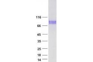 Validation with Western Blot