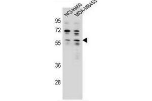 ANKRD34C Antibody (C-term) western blot analysis in NCI-H460,MDA-MB453 cell line lysates (35µg/lane). (ANKRD34C anticorps  (C-Term))