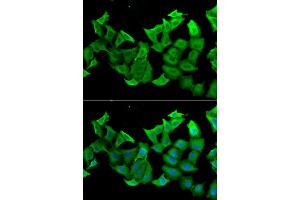 Immunofluorescence analysis of A549 cell using HAGH antibody. (HAGH anticorps)