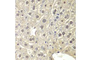 Immunohistochemistry of paraffin-embedded mouse liver using NR3C1 antibody at dilution of 1:200 (400x lens). (Glucocorticoid Receptor anticorps)