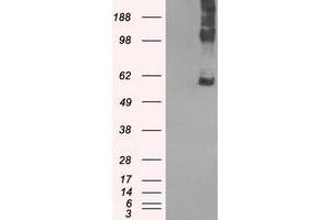 Image no. 2 for anti-Solute Carrier Family 7 (Amino Acid Transporter, L-Type), Member 8 (SLC7A8) antibody (ABIN1500964)