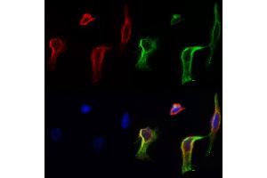 ABIN6258278 and ABIN6273860 staining Hela cells by IF/ICC. (GPR20 anticorps  (C-Term))