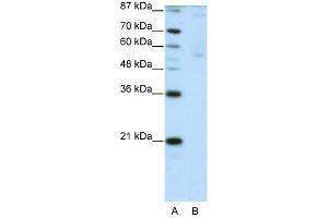 ZNF92 antibody (20R-1238) used at 0. (ZNF92 anticorps  (C-Term))