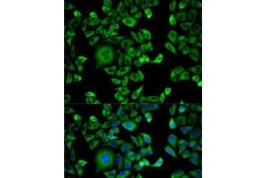 Immunofluorescence analysis of HeLa cells using EXT1 Polyclonal Antibody