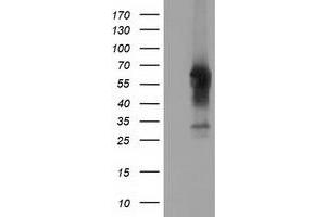 HEK293T cells were transfected with the pCMV6-ENTRY control (Left lane) or pCMV6-ENTRY CD5 (Right lane) cDNA for 48 hrs and lysed. (CD5 anticorps)