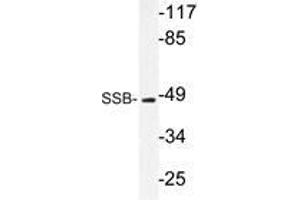 Western blot analysis of SSB antibody in extracts from 293 cells. (SSB anticorps)