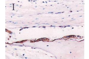 Immunohistochemistryimageof Osteopontin staining in paraffin section of fetal calvaria. (Osteopontin anticorps  (AA 59-74))