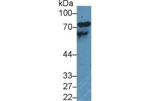 Detection of HMWK in Human Lung lysate using Polyclonal Antibody to High Molecular Weight Kininogen (HMWK)