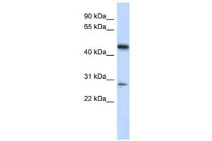 C13ORF31 antibody used at 1 ug/ml to detect target protein. (LACC1 anticorps  (Middle Region))
