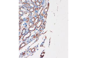 Immunohistochemistry of paraffin-embedded Mouse kidney using CHDH Rabbit pAb (ABIN7266341) at dilution of 1:100 (40x lens).