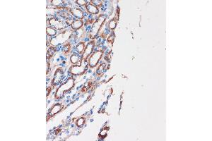 Immunohistochemistry of paraffin-embedded Mouse kidney using CHDH Rabbit pAb (ABIN7266341) at dilution of 1:100 (40x lens). (CHDH anticorps  (AA 245-594))