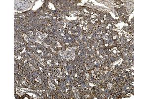 IHC analysis of Claudin 3/CLDN3 using anti-Claudin 3/CLDN3 antibody (ABIN7599626). (Claudin 3 anticorps  (AA 101-220))