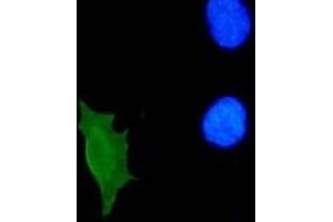 Immunofluorescence (IF) image for anti-Human Papilloma Virus 11 E7 (HPV-11 E7) (AA 36-70) antibody (ABIN781777) (Humain Papilloma Virus 11 E7 (HPV-11 E7) (AA 36-70) anticorps)