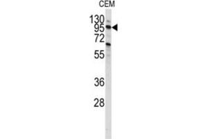 Western Blotting (WB) image for anti-Phosphoinositide-3-Kinase, Class 3 (PIK3C3) antibody (ABIN3000300) (PIK3C3 anticorps)