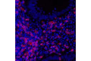 Immunofluorescence (IF) image for anti-CD3 epsilon (CD3E) (AA 157-207) antibody (ABIN7454035) (Recombinant CD3 epsilon anticorps  (AA 157-207))