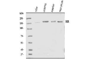 Western blot analysis of Insulin Receptor/INSR using anti-Insulin Receptor/INSR antibody (ABIN7600241).